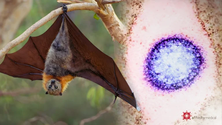 nipah virus