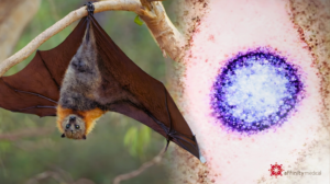 Nipah Virus Workplace Safety Advisory